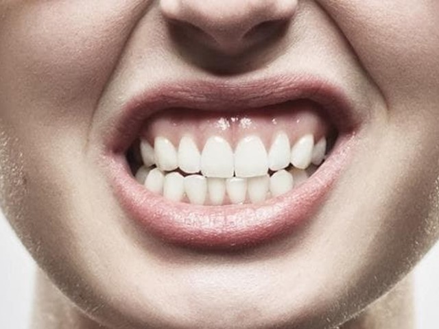 BRUXISMO, CÓMO DEJAR DE APRETAR LOS DIENTES Y DESCANSAR.