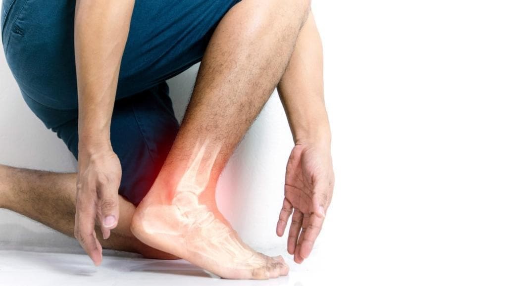 ¿Cuál es la diferencia entre fascitis plantar y espolón calcáneo? - Imagen 3