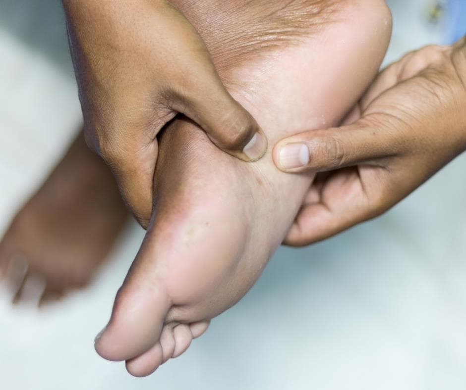 Fascitis plantar, espolones y edema óseo: ¿Cómo aliviar el dolor?