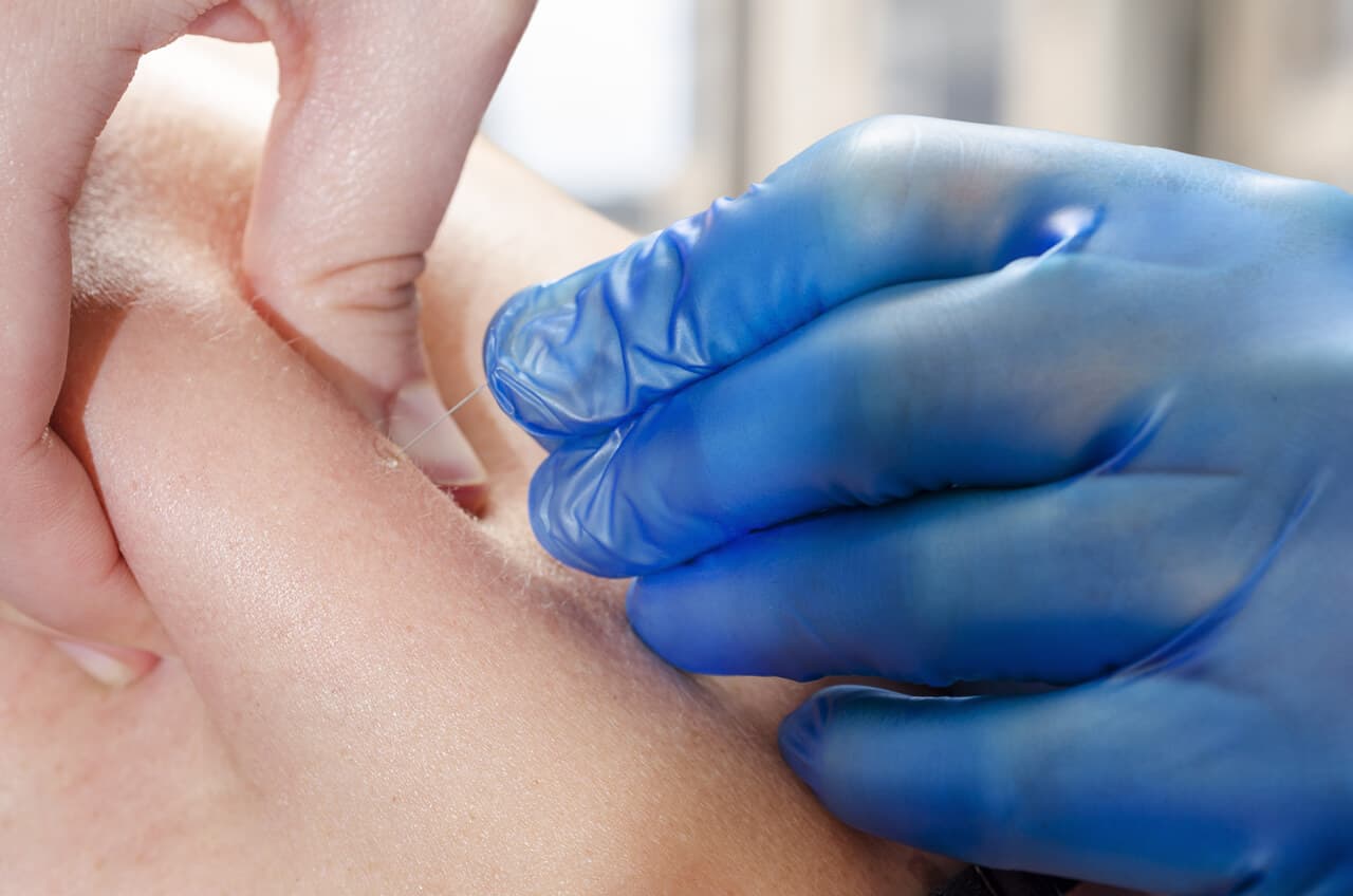 Técnicas de fisioterapia en Santiago de Compostela