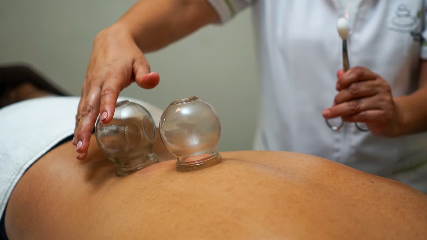 Terapia Cupping - Ventosas